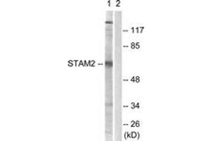 Western blot analysis of extracts from NIH-3T3 cells, treated with EGF 200ng/ml 30', using STAM2 (Ab-192) Antibody. (STAM2 antibody  (AA 161-210))