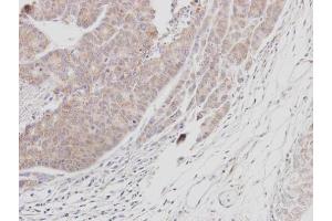 IHC-P Image Immunohistochemical analysis of paraffin-embedded SAS xenograft, using BTK, antibody at 1:100 dilution. (BTK antibody  (C-Term))