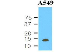 Western Blotting (WB) image for anti-Cystatin B (Stefin B) (CSTB) antibody (ABIN306448) (CSTB antibody)