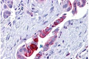 Human Pancreas, Duct: Formalin-Fixed, Paraffin-Embedded (FFPE) (Retinoblastoma Binding Protein 8 antibody  (Internal Region))