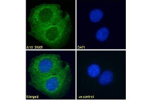 ABIN334464 Immunofluorescence analysis of paraformaldehyde fixed U2OS cells, permeabilized with 0. (SNX9 antibody  (Internal Region))