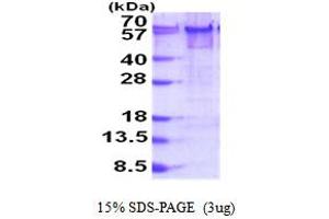SDS-PAGE (SDS) image for YY1 Transcription Factor (YY1) (AA 1-414) protein (His tag) (ABIN5853933)