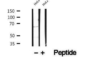 Western blot analysis of extracts of HeLa cells, using TSHR antibody. (TSH receptor antibody  (Internal Region))
