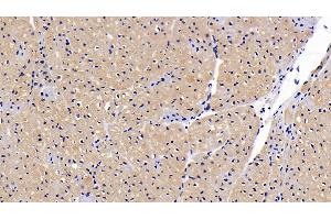 Detection of CNTFR in Porcine Cardiac Muscle Tissue using Polyclonal Antibody to Ciliary Neurotrophic Factor Receptor (CNTFR) (CNTF Receptor alpha antibody  (AA 120-358))