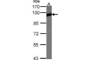 WB Image Sample (30 ug of whole cell lysate) A:NIH-3T3 7. (NFKB2 antibody  (C-Term))