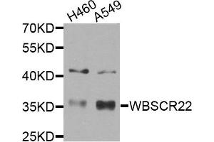 Western blot analysis of extracts of H460 and A549 cells, using WBSCR22 antibody.