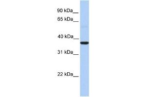 WB Suggested Anti-ZC3H15 Antibody Titration:  0. (ZC3H15 antibody  (Middle Region))