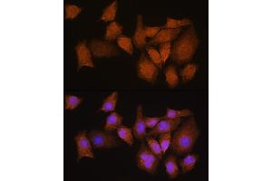 Immunofluorescence analysis of HeLa cells using NMN Rabbit pAb (ABIN7268910) at dilution of 1:100. (NMNAT3 antibody  (AA 1-215))
