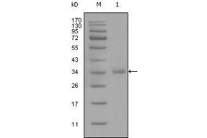 Western blot analysis using anti-CD45 monoclonal antibody against truncated CD45 recombinant protein (1). (CD45 antibody)