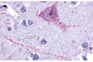 Anti-TACR3 antibody  ABIN1049391 IHC staining of human brain, neurons and glia. (TACR3 antibody  (N-Term))