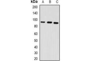 Western blot analysis of GPAM expression in mouse heart (A), mouse lung (B), rat brain (C) whole cell lysates. (GPAM antibody)