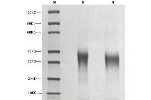 5 μg of EPO-α, Human  was resolved with SDS-PAGE under reducing (R) and non-reducing (N) conditions and visualized by Coomassie Blue staining. (EPO Protein (AA 28-193))