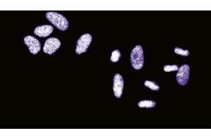 Immunofluorescent staining of HeLa cells. (SSB antibody  (AA 179-289))
