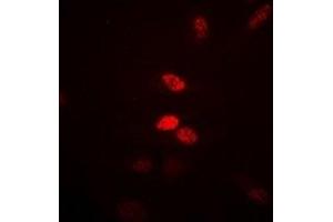 Immunofluorescent analysis of Visfatin staining in Hela cells.