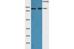 L1 mouse brain lysate L2 mouse heart lysates probed with Anti Phospho-ATG1(Ser556)Polyclonal Antibody, Unconjugated  at 1:3000 for 90 min at 37˚C. (ULK1 antibody  (pSer556))