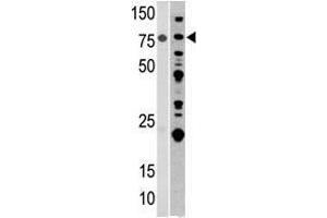 Image no. 1 for anti-Aconitase 2, Mitochondrial (ACO2) (Center) antibody (ABIN357262) (ACO2 antibody  (Center))