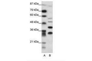 Image no. 1 for anti-Growth Factor Independent 1 (GFI1) (N-Term) antibody (ABIN6736088) (GFI1 antibody  (N-Term))