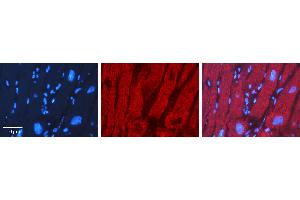 Rabbit Anti-XBP1 Antibody   Formalin Fixed Paraffin Embedded Tissue: Human heart Tissue Observed Staining: Cytoplasmic Primary Antibody Concentration: 1:100 Other Working Concentrations: 1:600 Secondary Antibody: Donkey anti-Rabbit-Cy3 Secondary Antibody Concentration: 1:200 Magnification: 20X Exposure Time: 0. (XBP1 antibody  (N-Term))
