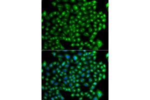 Immunofluorescence analysis of A549 cells using ZFYVE1 antibody (ABIN5975594). (ZFYVE1 antibody)