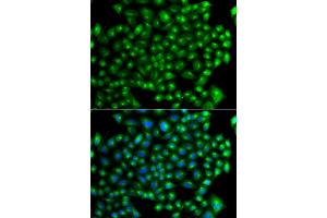 Immunofluorescence analysis of A549 cells using ZFYVE1 antibody (ABIN5975594).