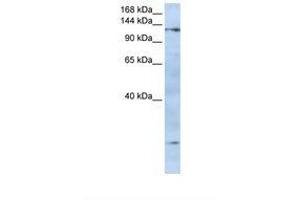 Image no. 1 for anti-Formin-Like 2 (FMNL2) (N-Term) antibody (ABIN6738399) (FMNL2 antibody  (N-Term))