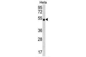 CHI3L2 Antibody (N-term) western blot analysis in Hela cell line lysates (35µg/lane).