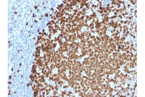 Formalin-fixed, paraffin-embedded human Tonsil stained with Ki67 Mouse Monoclonal Antibody (MKI67/2461). (Ki-67 antibody  (AA 2293-2478))