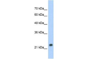 WB Suggested Anti-HSPB1 Antibody Titration: 1. (HSP27 antibody  (C-Term))