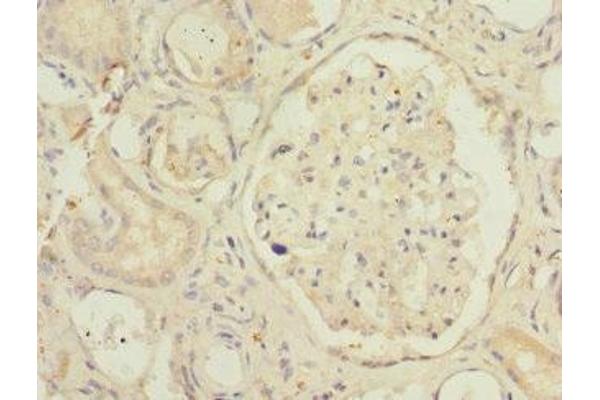SMPX antibody  (AA 1-88)