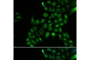 Immunofluorescence analysis of U2OS cells using TSPAN7 Polyclonal Antibody (Tetraspanin 7 antibody)