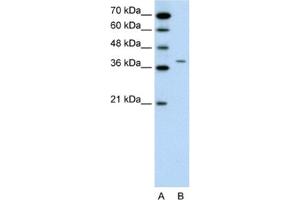 Western Blotting (WB) image for anti-Receptor-Associated Protein of The Synapse (RAPSN) antibody (ABIN2462657)