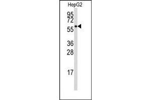 Image no. 1 for anti-Aldehyde Dehydrogenase 3 Family, Member B1 (ALDH3B1) (Middle Region) antibody (ABIN360240) (ALDH3B1 antibody  (Middle Region))