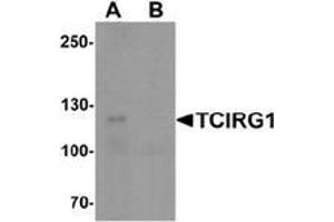 Western blot analysis of TCIRG1 in EL4 cell lysate with TCIRG1 Antibody  at 0. (TCIRG1 antibody  (N-Term))