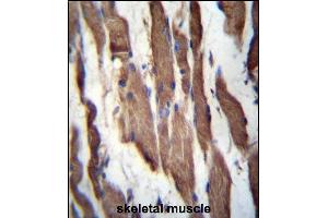 TGFBR Antibody (C-term) 3395b immunohistochemistry analysis in formalin fixed and paraffin embedded human skeletal muscle followed by peroxidase conjugation of the secondary antibody and DAB staining. (TGFBRAP1 antibody  (C-Term))