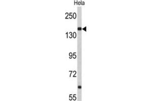 Western Blotting (WB) image for anti-Nucleoporin 153kDa (NUP153) antibody (ABIN3004036) (NUP153 antibody)