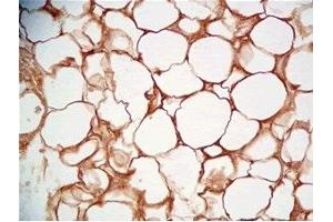 Rat visceral fat tissue was stained by Rabbit Anti-Cathepsin S (298-331) (Human) Serum (Cathepsin S antibody  (AA 298-331))