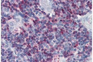 Immunohistochemistry staining of human thymus (paraffin sections) with anti-SLP76 polyclonal.