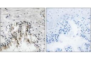 Immunohistochemistry analysis of paraffin-embedded human prostate carcinoma tissue, using RPL31 Antibody. (RPL31 antibody  (AA 61-110))