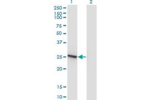 Western Blot analysis of RAB32 expression in transfected 293T cell line by RAB32 monoclonal antibody (M01), clone 1C7. (RAB32 antibody  (AA 136-225))