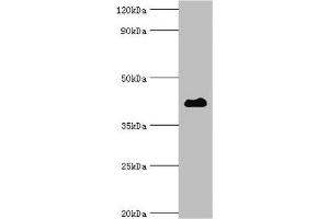 Western blot Western blot All lanes: Histone deacetylase 8 antibody at 2 μg/mL + Hela whole cell lysate Secondary Goat polyclonal to rabbit IgG at 1/10000 dilution Predicted band size: 42, 30, 18, 32, 29, 16, 17 kDa Observed band size: 42 kDa (HDAC8 antibody  (AA 1-377))