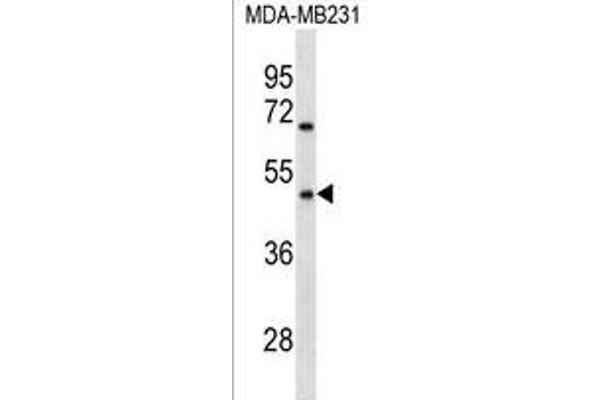 OR1Q1 antibody  (C-Term)