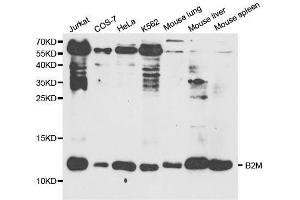 Western blot analysis of extracts of various cell lines, using B2M antibody. (beta-2 Microglobulin antibody  (AA 21-119))