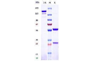 Anti-TNFRSF10B / TRAILR2 / CD262 Reference Antibody (drozitumab) on SDS-PAGE under reducing (R) condition. (Recombinant TNFRSF10B (Drozitumab Biosimilar) antibody)