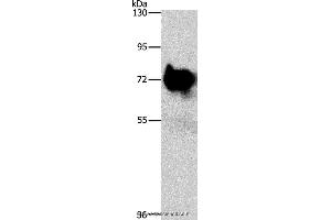 Western blot analysis of Mouse brain tissue, using SYN1 Polyclonal Antibody at dilution of 1:750 (SYN1 antibody)