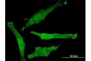 Immunofluorescence of monoclonal antibody to SNAP29 on HeLa cell. (SNAP29 antibody  (AA 1-258))