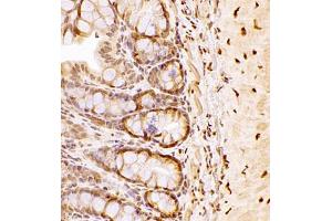 Immunohistochemistry of paraffin embedded rat colon using NAIF1 (ABIN7074867) at dilution of 1:2500 (400x lens) (NAIF1 antibody)