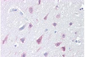 Anti-NPC1 antibody IHC staining of human brain, cortex. (NPC1 antibody  (C-Term))