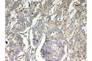 Immunohistochemistry (IHC) image for anti-Tetraspanin 12 (TSPAN12) antibody (ABIN5708348)