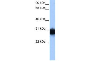 WB Suggested Anti-TPI1 Antibody Titration:  0. (TPI1 antibody  (N-Term))