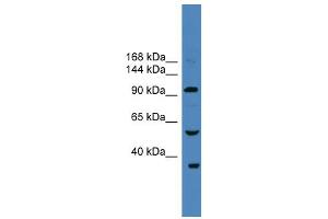 WB Suggested Anti-USP29 Antibody Titration: 0. (USP29 antibody  (N-Term))